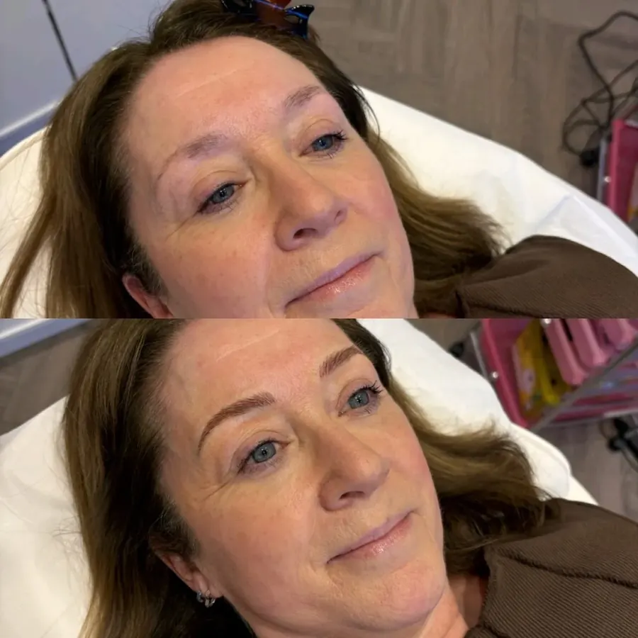Sparse brows transformed with natural microblading strokes, Cheshire