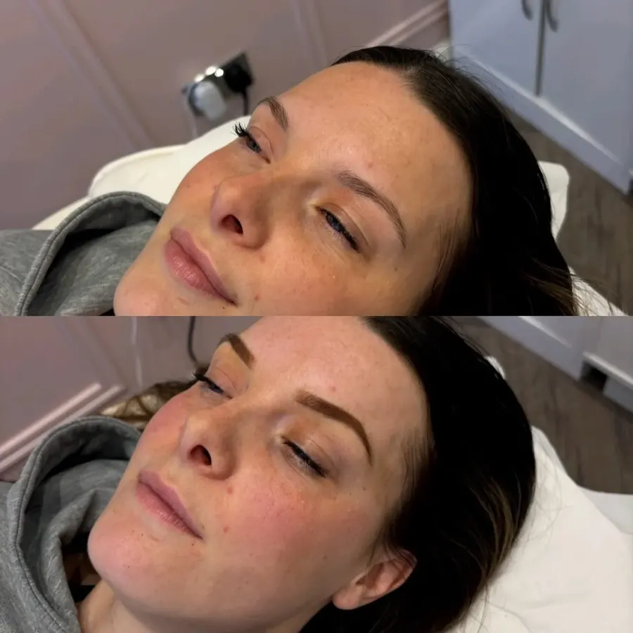 Freshly finished microbladed eyebrows, balanced and symmetrical, Cheshire