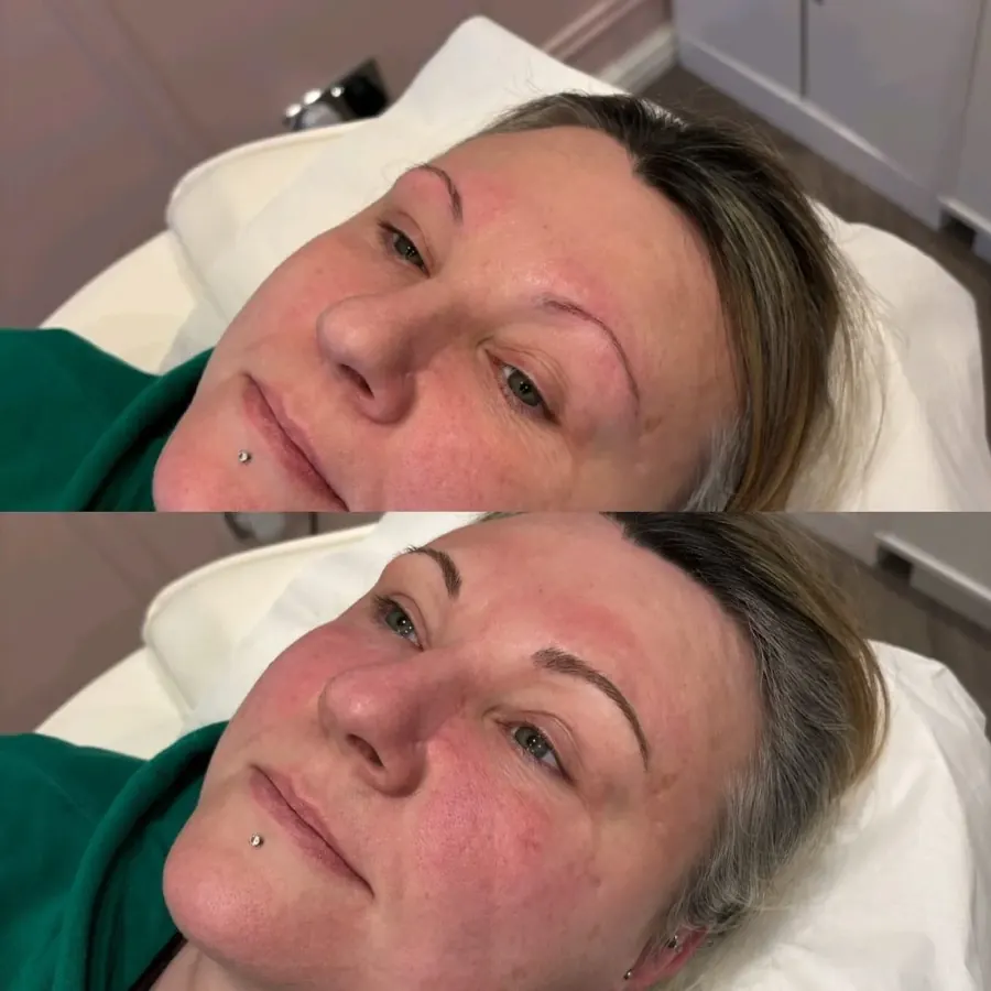 Close-up of healed microbladed brow hair strokes, permanent makeup in Cheshire